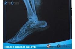 China Radiology Blue Inkjet Medical X - ray Film Waterproof Inkjet Printing Film supplier