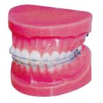 China Normal Fixed Orthodontic Model for Hospitals And Medical Schools Training for sale