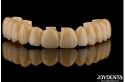 China High Flexibility Zirconia Hybrid Bridge With Titanium Base High Aesthetic supplier