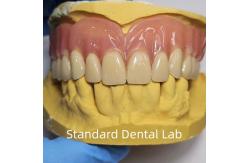 China Standard Ivoclar Complete Acrylic Denture Professional FDA Certified supplier