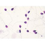 BRED-015 Sperm Morphology Staining Kit Diff Quik Rapid Staining Method for sale