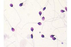 China BRED-015 Sperm Morphology Staining Kit Diff Quik Rapid Staining Method supplier