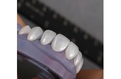 China Natural looking Emax Veneers Crown Biocompatibility Bleaching Shade with Minimal Preparation supplier