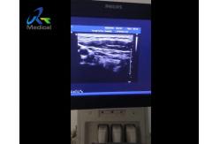 China IE33 Ultrasound Machine Repair Small Parts Probe Image Loss supplier