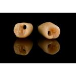 Internal Hex Connection Sandblasted Titanium Dental Implants Single Tooth Replacement