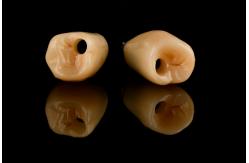 China Internal Hex Connection Sandblasted Titanium Dental Implants Single Tooth Replacement supplier