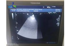 China Toshiba Aplio 300 Echo Zone Has Shadows Ultrasound Repair Service Replace Control Panel supplier