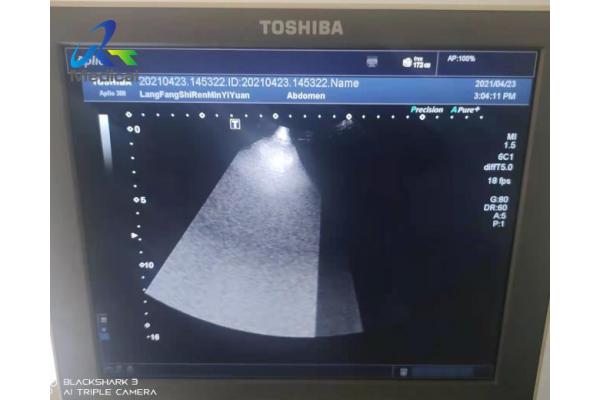 Toshiba Aplio 300 Echo Zone Has Shadows Ultrasound Repair Service Replace Control Panel