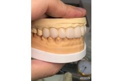 China Customized Shades To Match Natural Teeth Biocompatible And Stain Resistant Dental Veneers supplier