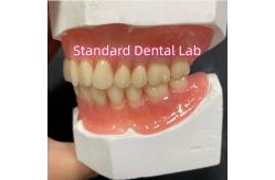 China Full Upper And Lower Stayplate Acrylic Partial Dentures Ivoclar Teeth Pink Gum supplier