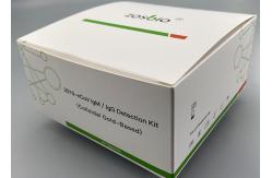 China 2019-NCoV IgM IgG Test Kit ( Colloidal Gold-Based ) Test Method supplier