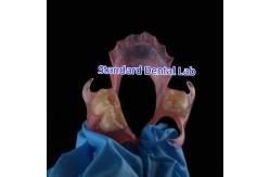 China Dental PFM Crown manufacturer