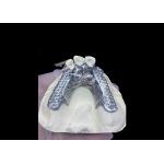 Easy Fit Custom Cast Partial Denture Stable and Natural-looking Framework for Fast Results for sale