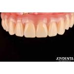 Dental Treatment High Elasticity Acrylic False Teeth Finish For Tooth Arrangement for sale