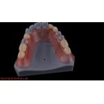 3D Print Model High Esthetics Dental TCS Valplast Flexible Partial Dentures Dental Lab for sale
