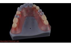 China 3D Print Model High Esthetics Dental TCS Valplast Flexible Partial Dentures Dental Lab supplier