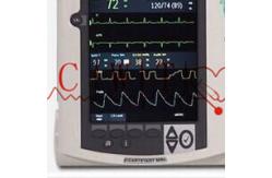 China 12 Inch Aed Heart Machine , Adult Used Electric Shock Machine For Heart supplier