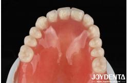 China Good Elasticity Dental Acrylic Denture Finish With Tooth Arrangement Technology supplier