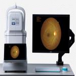 One Key Click Non Mydriatic Fundus Camera 3264×2488 Mini Picture Acquired Automatically for sale