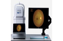 China One Key Click Non Mydriatic Fundus Camera 3264×2488 Mini Picture Acquired Automatically supplier