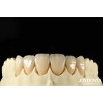 Bionic Development Leaves And Distinct Layers Of Zirconia All-Ceramic for sale
