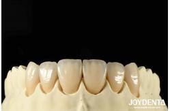 China Bionic Development Leaves And Distinct Layers Of Zirconia All-Ceramic supplier