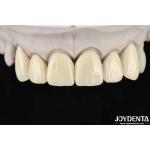 6.0-6.1 G/cm3 Density Layered Zirconia For High Translucency In CAD / CAM Milling for sale