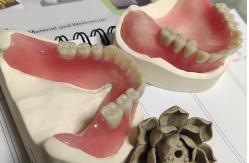 China Full Arch Acrylic Partial Denture supplier