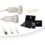 Linear 7.5Mhz 2.4G Wifi Wireless Ultrasound Probe 40mm Length for sale
