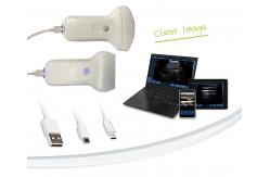China Linear 7.5Mhz 2.4G Wifi Wireless Ultrasound Probe 40mm Length supplier