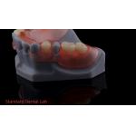 3D Print Model High Esthetics Dental TCS Valplast Flexible Partial Dentures Dental Lab