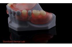 China 3D Print Model High Esthetics Dental TCS Valplast Flexible Partial Dentures Dental Lab supplier
