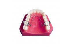 China Experience Effective Crossbite Palatal Expansion with CCC Certified Quad Helix Orthodontic Appliance supplier