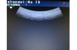 China Aloka UST-9123 60Mm Used Ultrasound Probe Convex Supersonic Sensor supplier