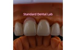 China Highly Biocompatible PFZ Porcelain Layered Zirconia With Pink Gum supplier