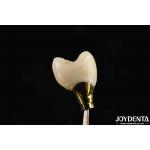 Various Sizes Implant Crown And Bridge For Strong Dental Implants Compatibility for sale