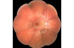 China OCT Automated Fundus Camera High Resolution For Choroid supplier