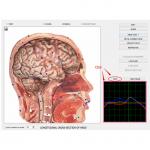 Bio-resonance Diagnostics 8d NLS / 9D NLS Body Health Analysis System Machine for sale