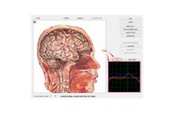 China Bio-resonance Diagnostics 8d NLS / 9D NLS Body Health Analysis System Machine supplier