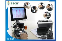 China Portable Video Microcirculation Microscope Nailfold Capillary with CE supplier