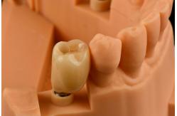 China Internal Hex Connection Sandblasted Titanium Dental Implants Single Tooth Replacement supplier