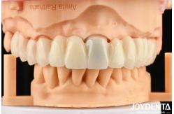China Seamless Gradient Dental PMMA Multilayer Design For Natural Shade Transitions supplier