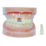 China Detachable Teeth Model WIthout Root for Hospitals And Dental Prevention Training for sale