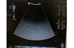 China GE 8C-RS Ultrasound Probe Repair Service Acoustic Lens Replacement supplier