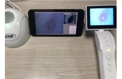 China Digital Magnicication Video Dermatoscope Skin and Scalp Analyzer with 50, 200 Times Lens supplier