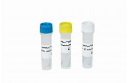 China Anti-Sperm antibody IgG detection (MAR method) supplier