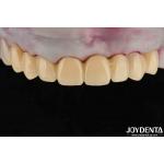 High Transparency PMMA Dental Material Natural Color Lifelike Aesthetics for sale
