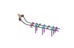 China Vertebar Rods System Posterior Cervical Screws Insert Spine Fixation Device supplier
