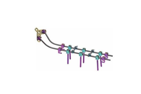 Vertebar Rods System Posterior Cervical Screws Insert Spine Fixation Device