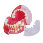 China Three - year - old Primary and Permanent Teeth Alternating Model / 3d tooth model for sale